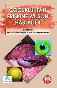 Çocukluktan Erişkine Wilson Hastalığı